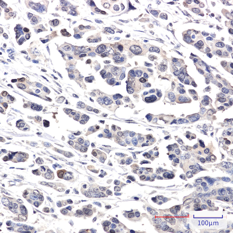 CRCP Rabbit mAb ABZ3401