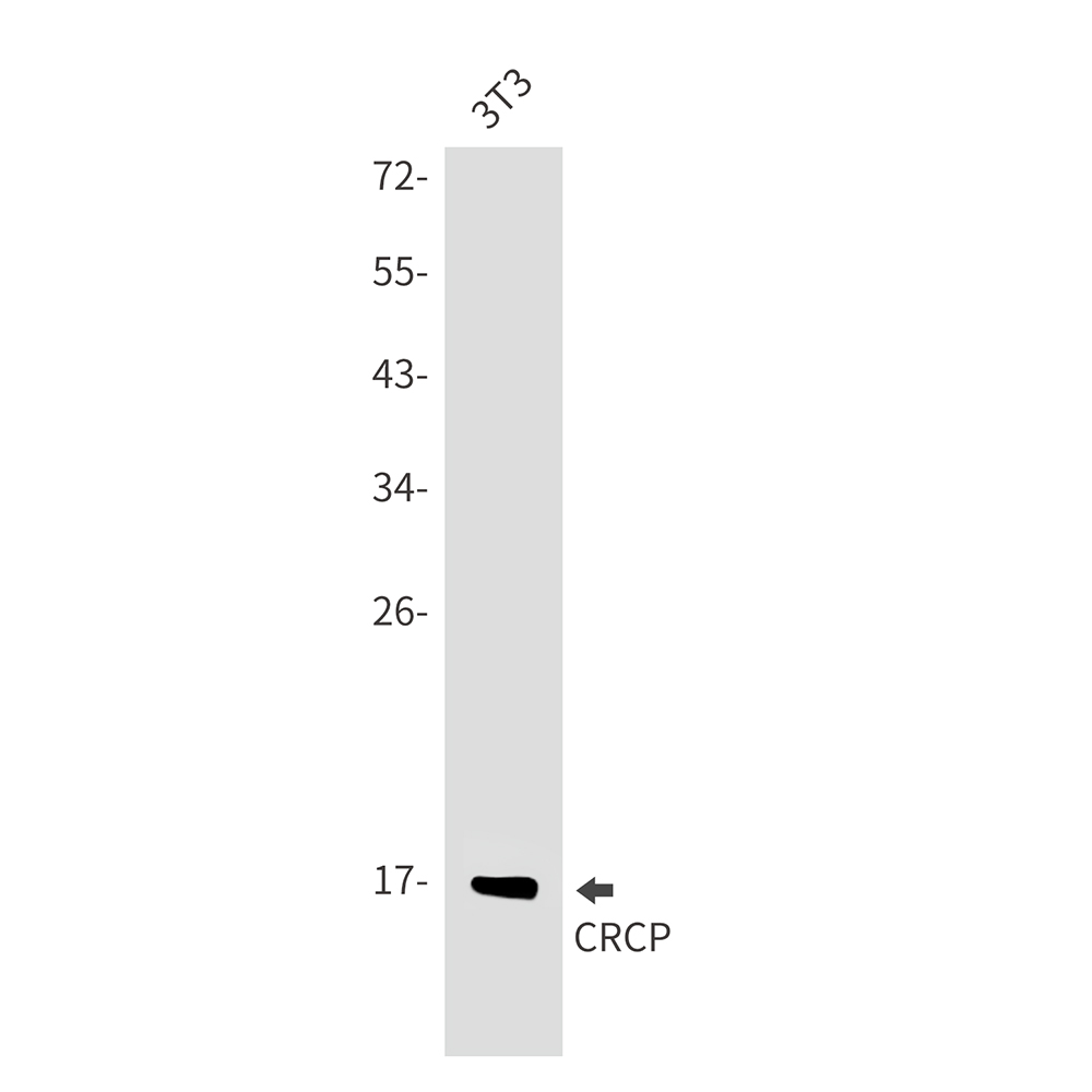 CRCP Rabbit mAb ABZ3401