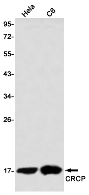 CRCP Rabbit mAb ABZ3401