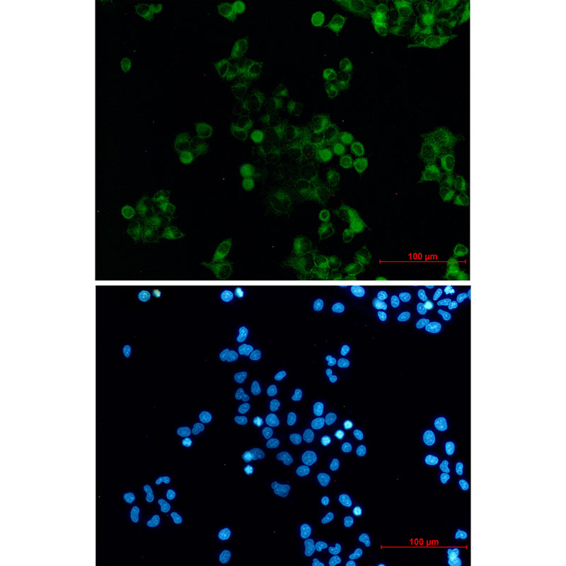 DAB2 Rabbit mAb ABZ3402