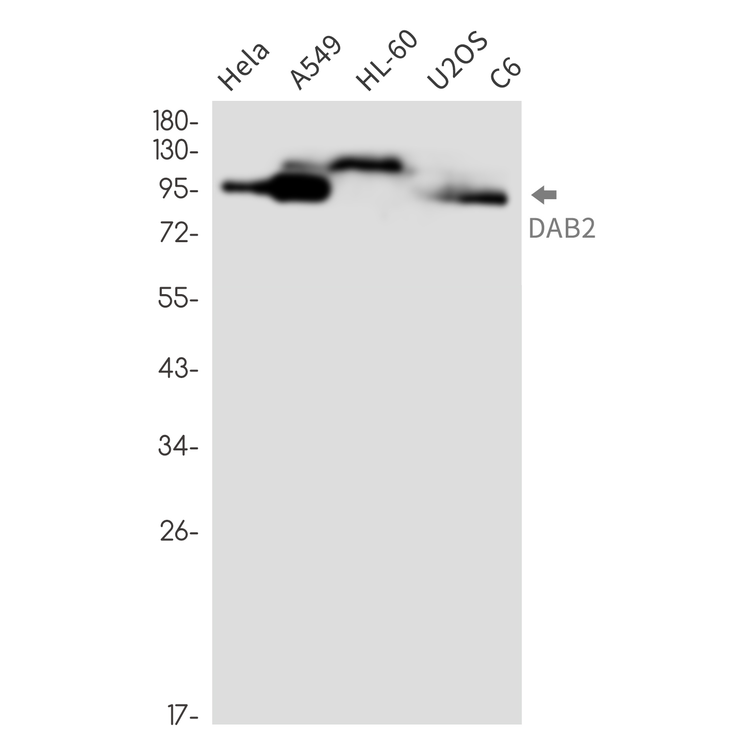 DAB2 Rabbit mAb ABZ3402