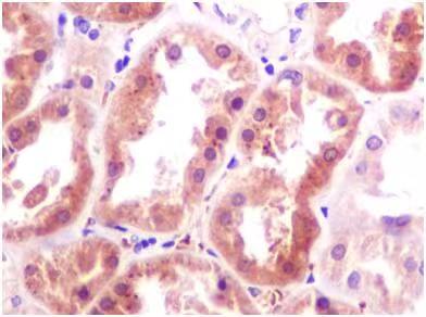 Klotho Rabbit mAb ABZ3403