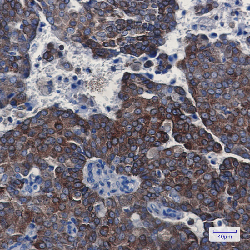 Bcl 2 Rabbit mAb ABZ3404