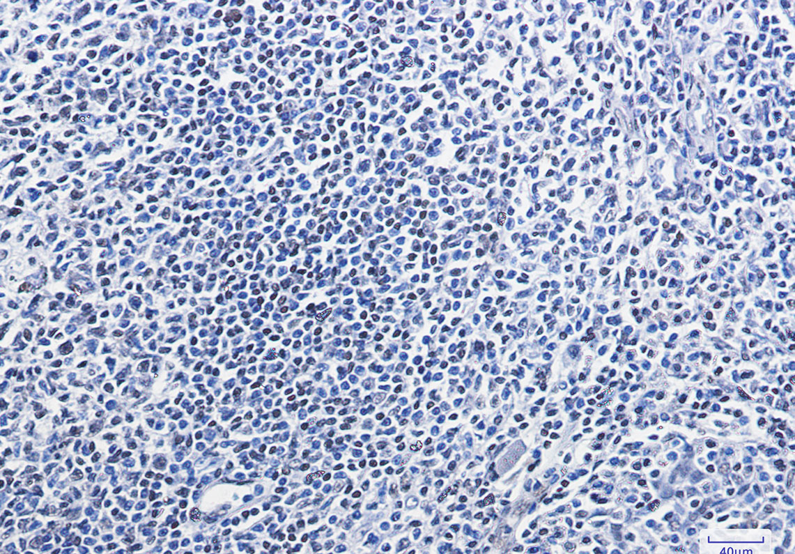 HMGB1 Rabbit mAb ABZ3405