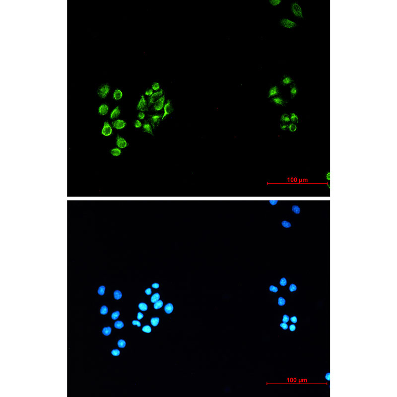 Vimentin Rabbit mAb ABZ3406
