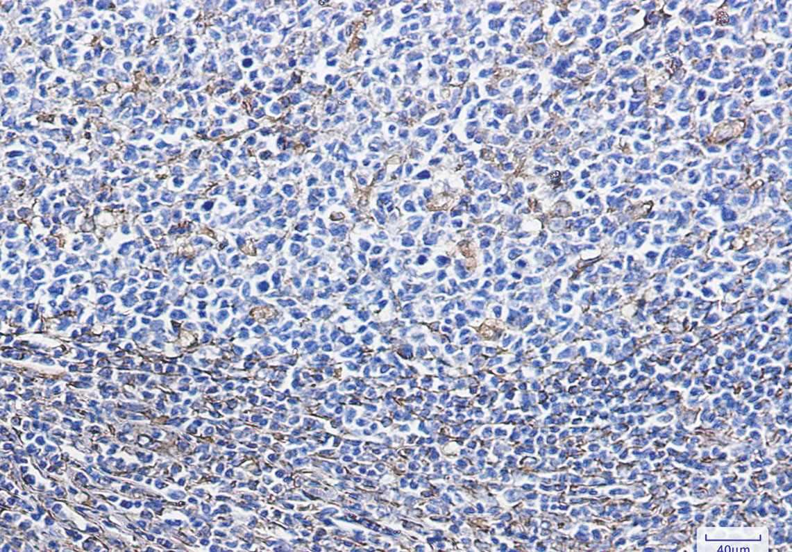 Vimentin Rabbit mAb ABZ3406