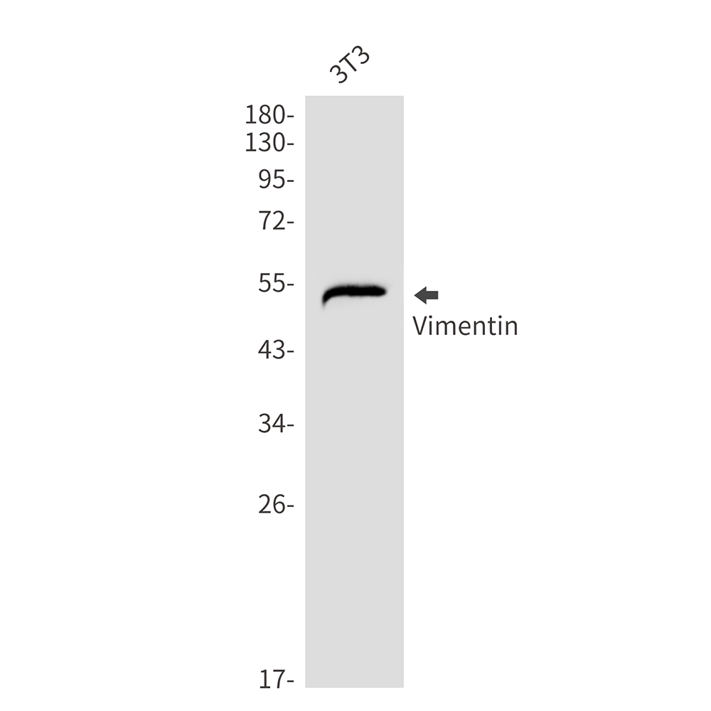 Vimentin Rabbit mAb ABZ3406