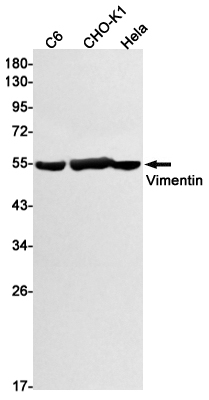 Vimentin Rabbit mAb ABZ3406
