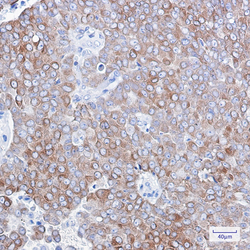 Bcl 2 Rabbit mAb ABZ3407