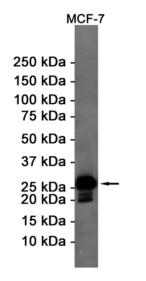 Bcl 2 Rabbit mAb ABZ3407