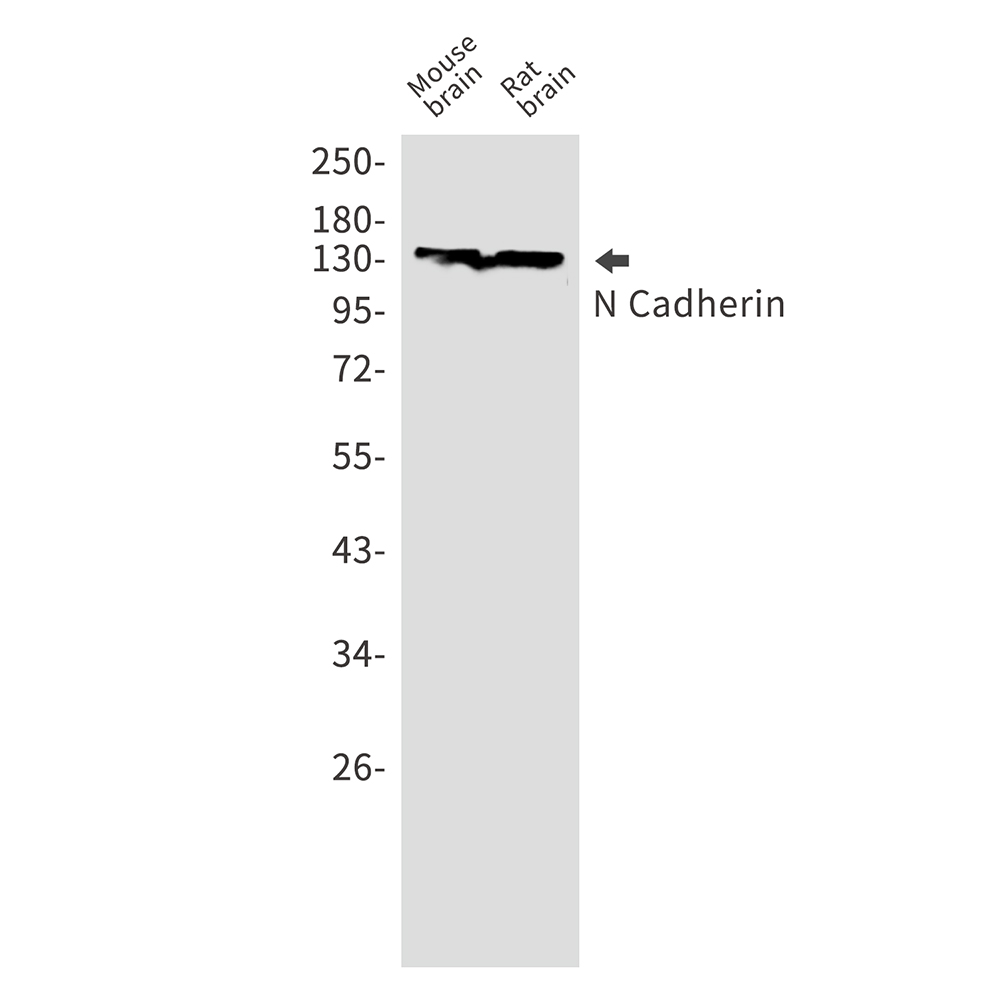 N Cadherin Rabbit mAb ABZ3408