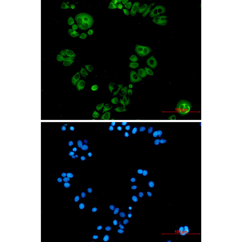 Alkaline Phosphatase Rabbit mAb ABZ3409