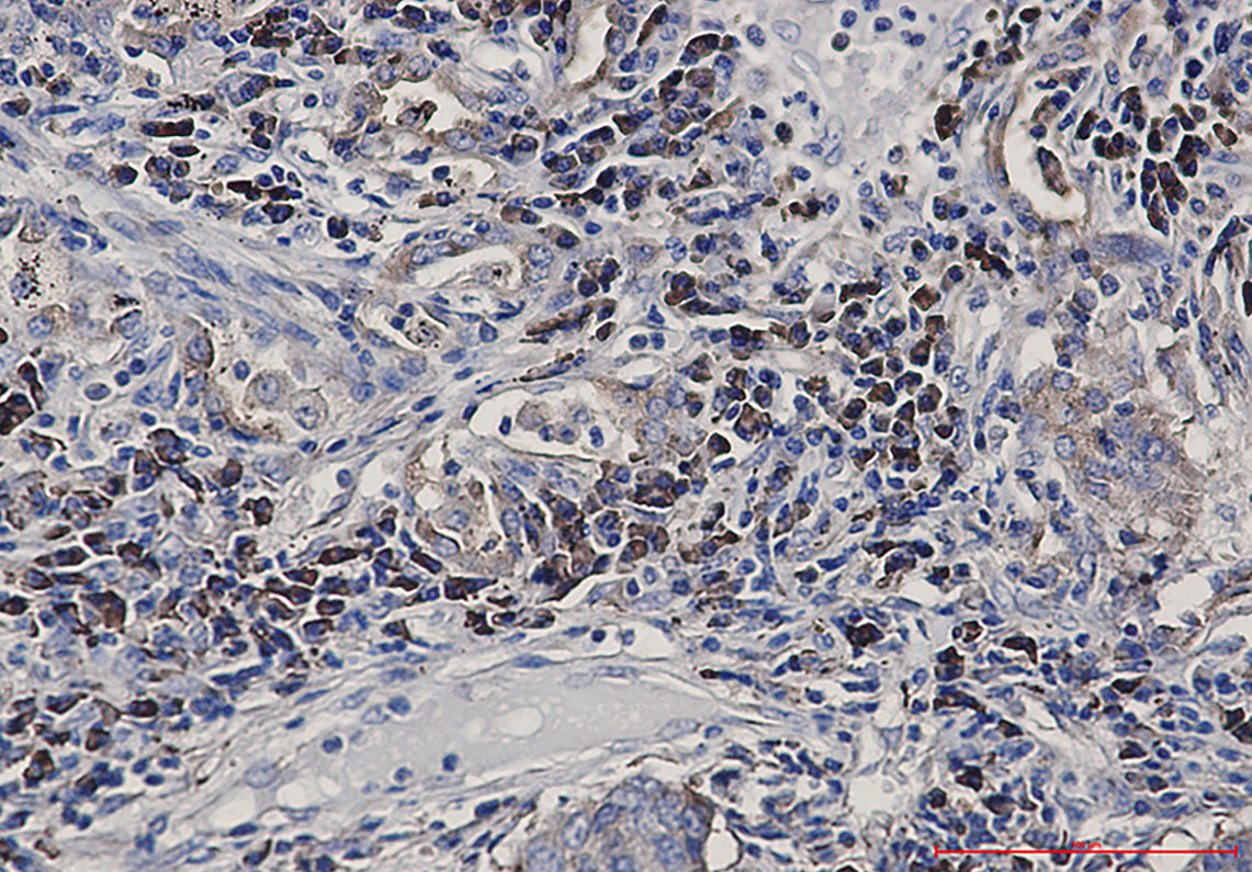 Alkaline Phosphatase Rabbit mAb ABZ3409