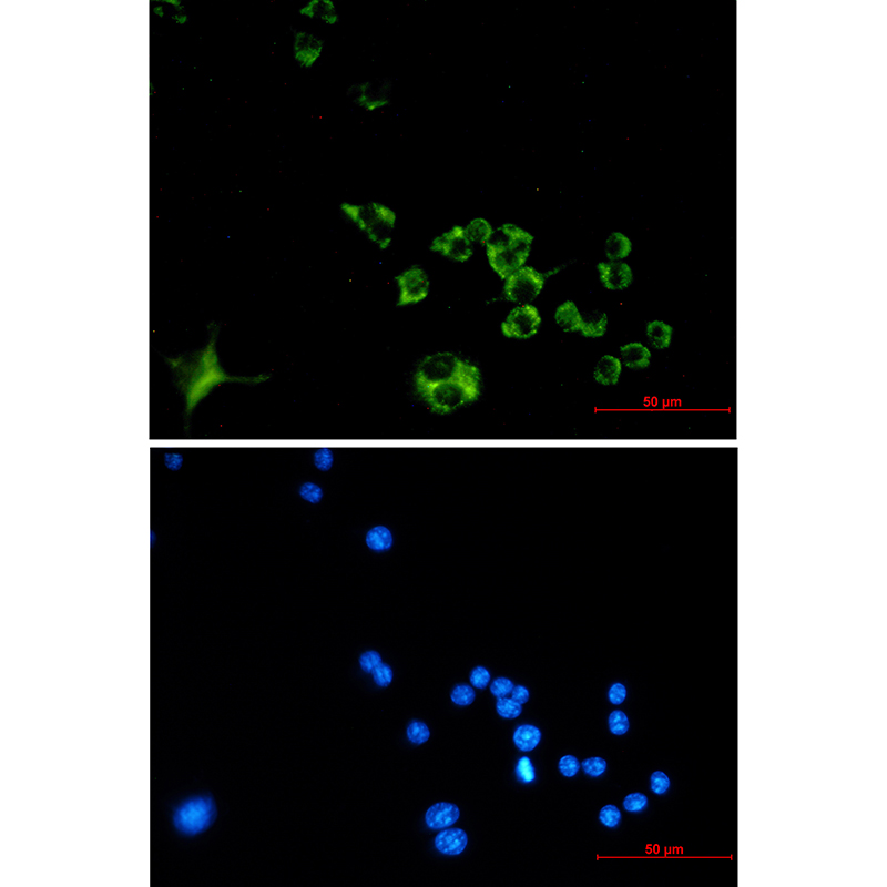 Cathepsin B Rabbit mAb ABZ3410