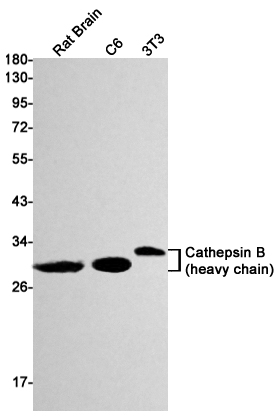 Cathepsin B Rabbit mAb ABZ3410