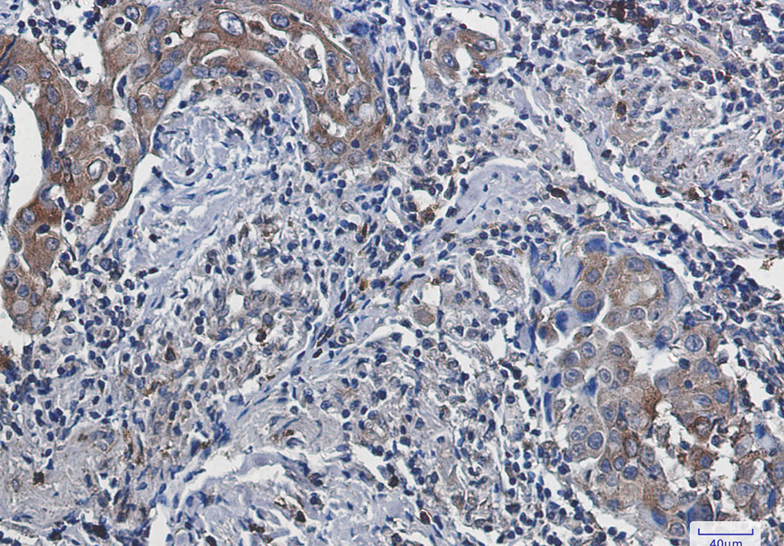 FACL4 Rabbit mAb ABZ3411