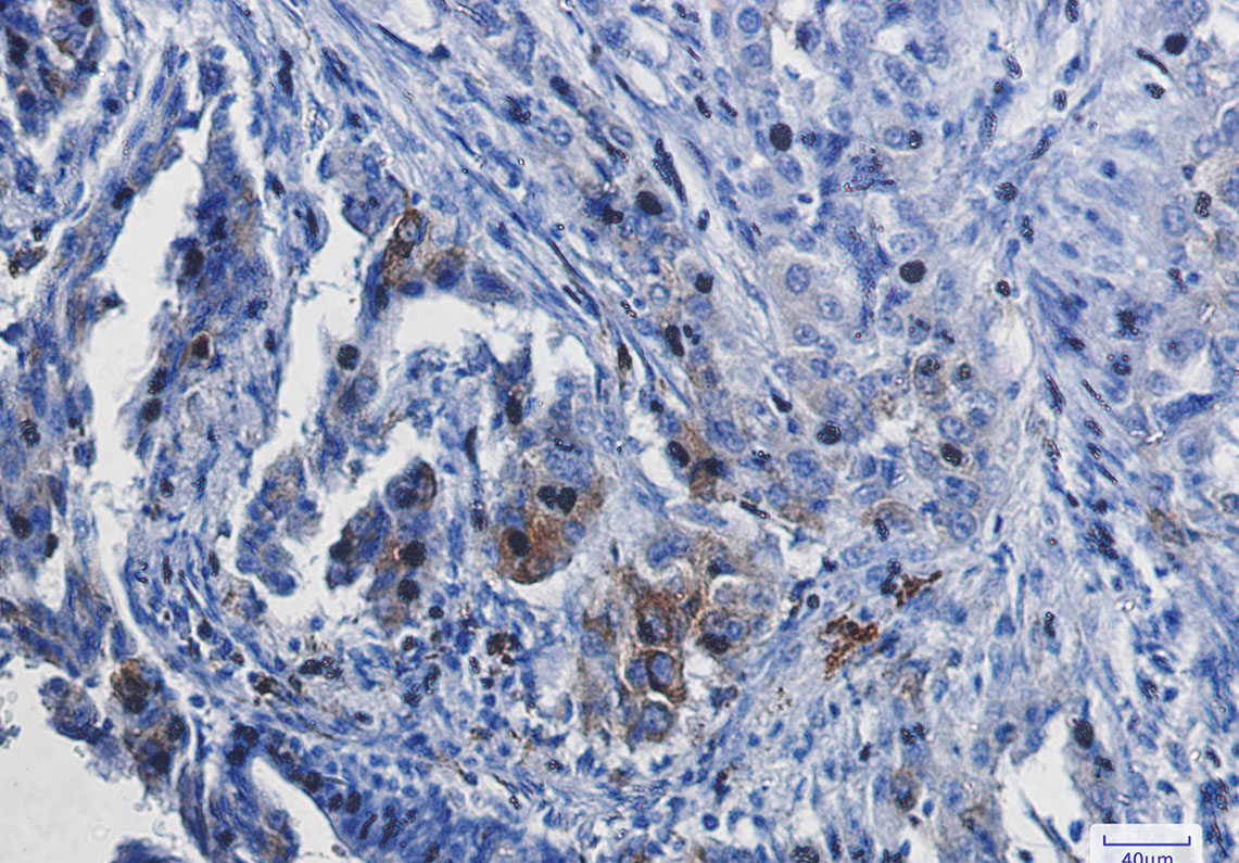 Heme Oxygenase 1 Rabbit mAb ABZ3412