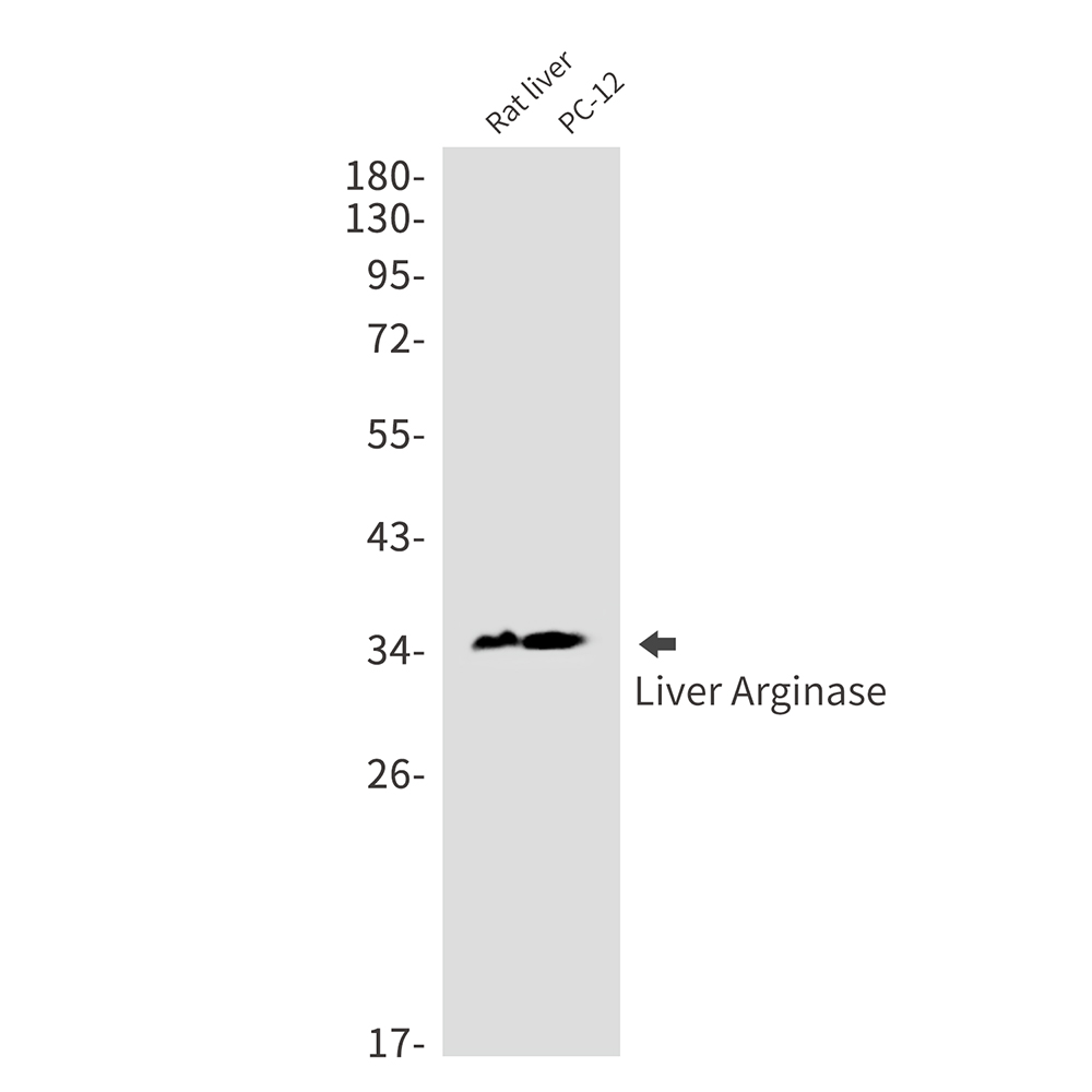Liver Arginase Rabbit mAb ABZ3415