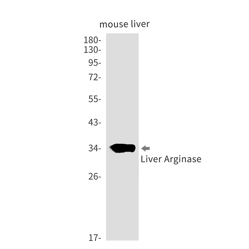 Liver Arginase Rabbit mAb ABZ3415