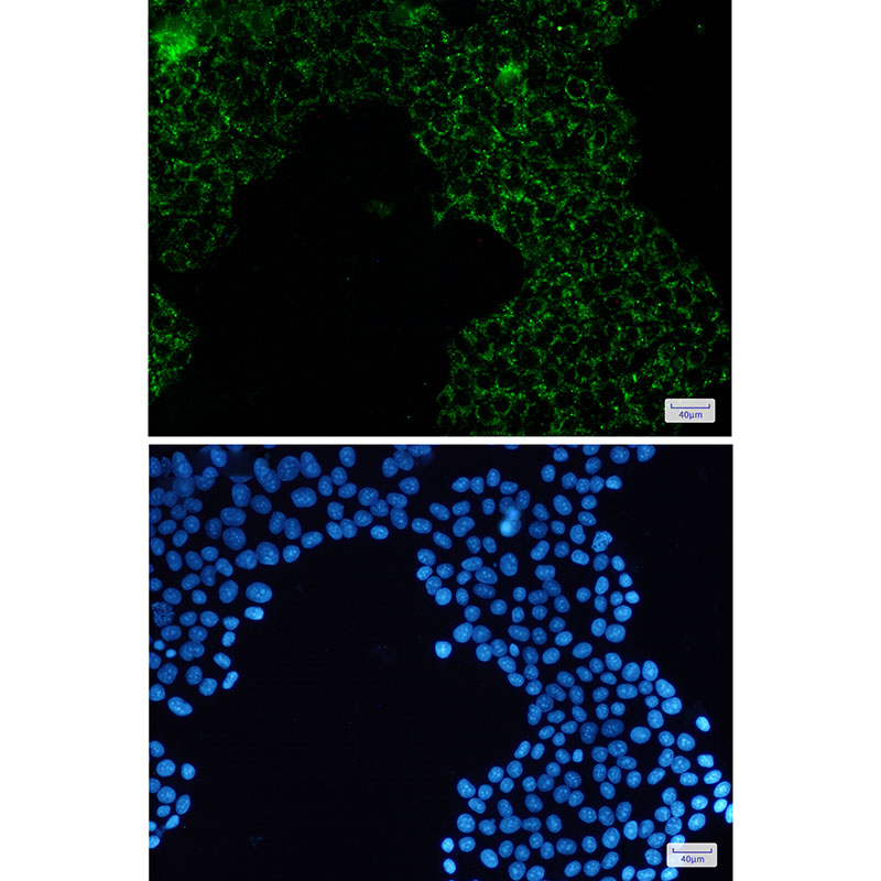 Pyruvate Dehydrogenase E1 alpha Rabbit mAb ABZ3416