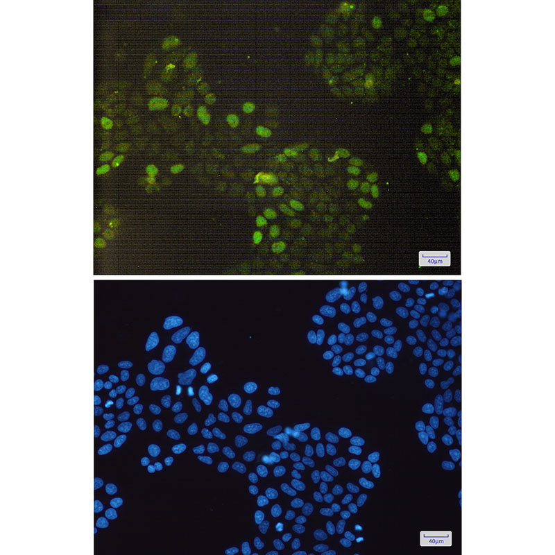 Rb Rabbit mAb ABZ3417