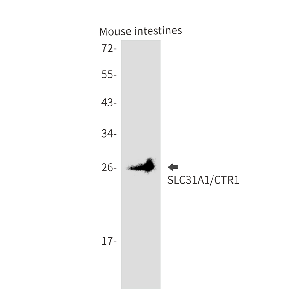 SLC31A1 Rabbit mAb ABZ3419