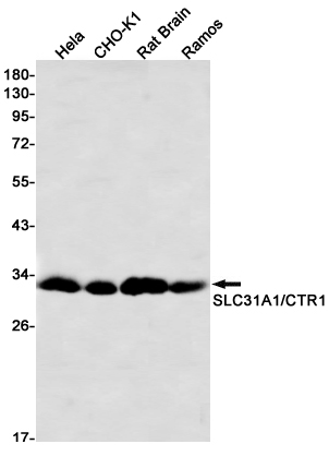SLC31A1 Rabbit mAb ABZ3419