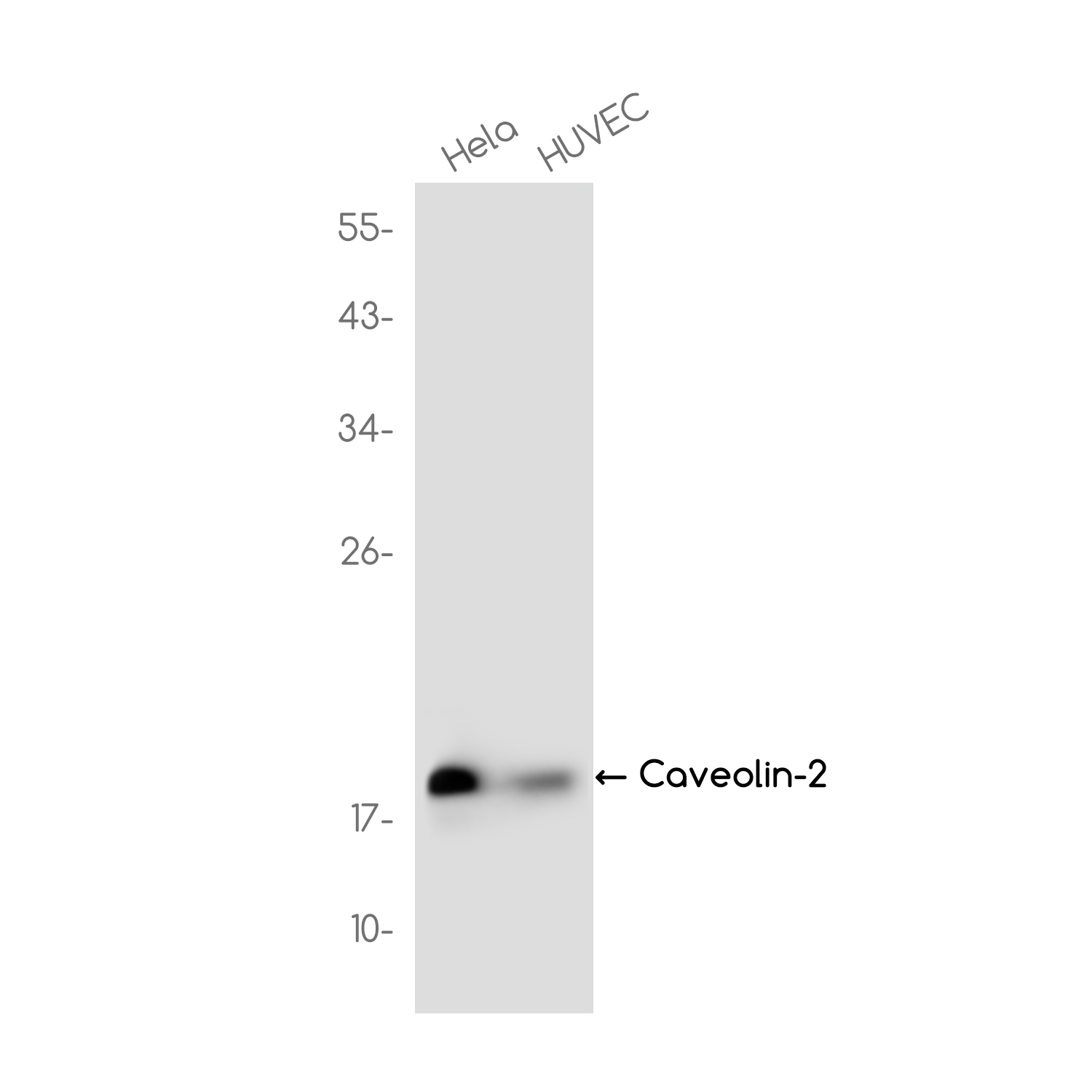 Caveolin-2 Rabbit mAb ABZ3698