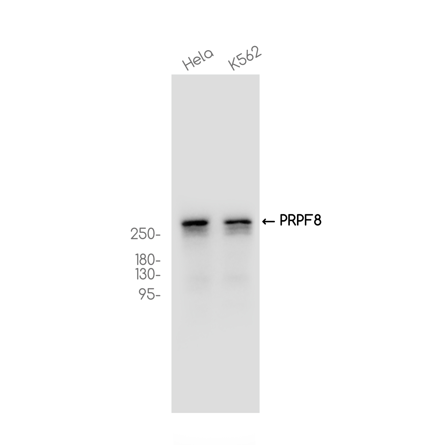 PRPF8 Rabbit mAb ABZ3707