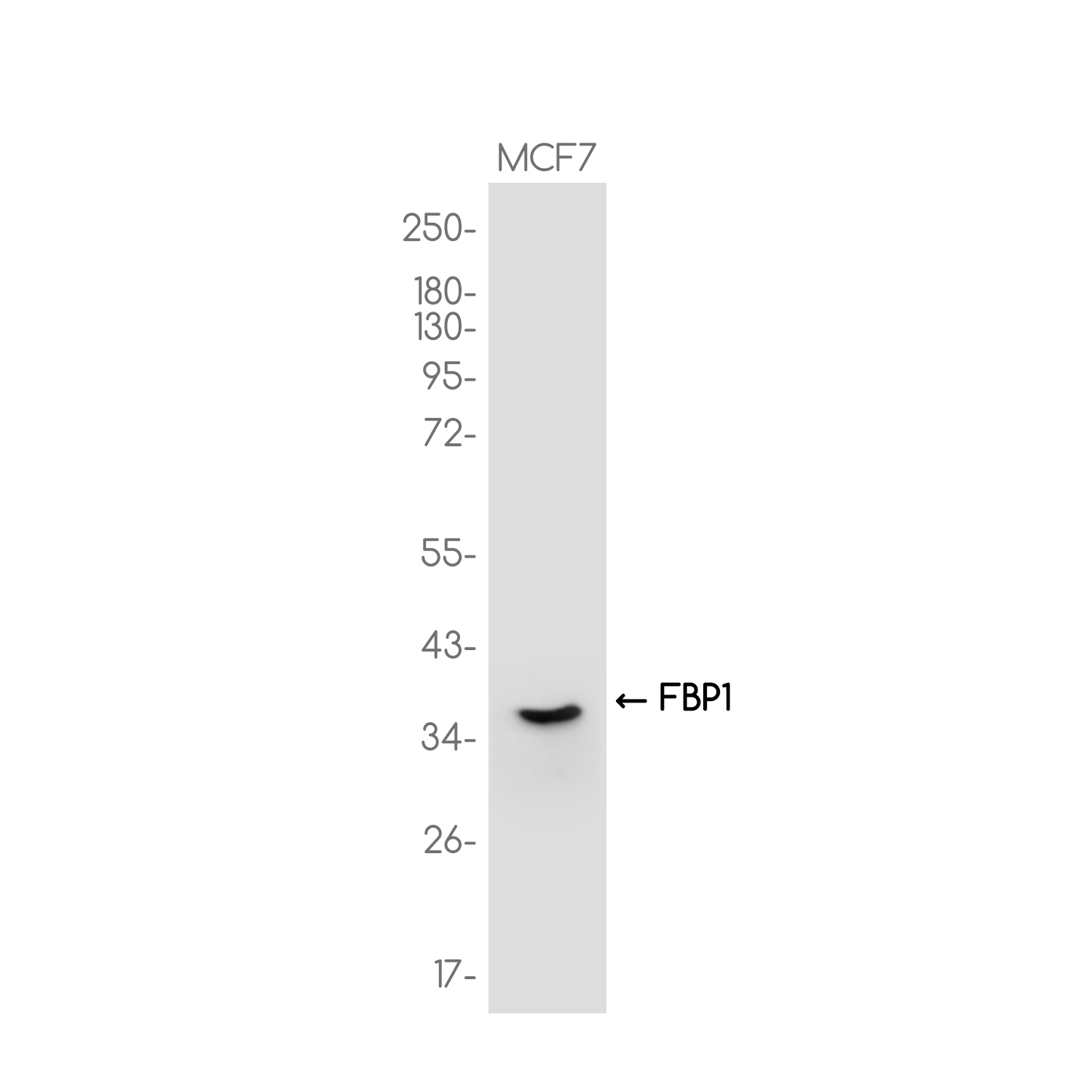FBP1 Rabbit mAb ABZ3708