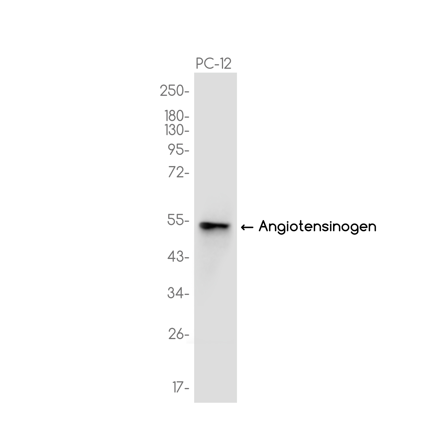 Angiotensinogen Rabbit mAb ABZ3710
