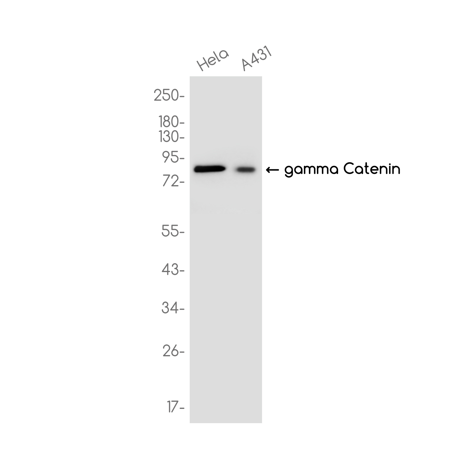 gamma Catenin Rabbit mAb ABZ3711