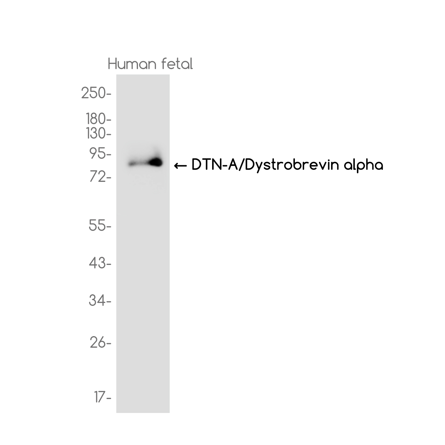 DTNA Rabbit mAb ABZ3712