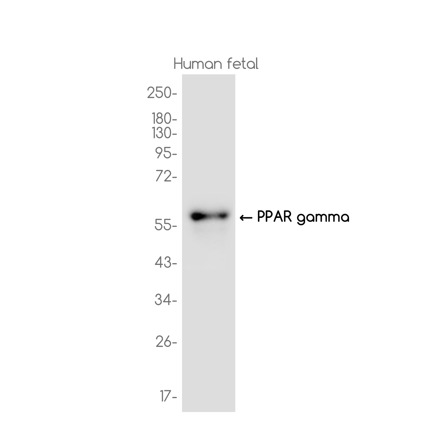 PPAR gamma Rabbit mAb ABZ3713