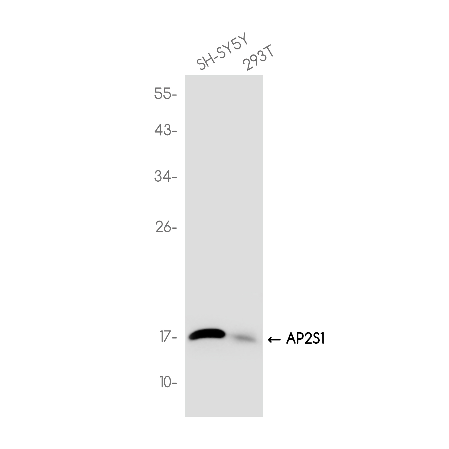 AP2S1 Rabbit mAb ABZ3714