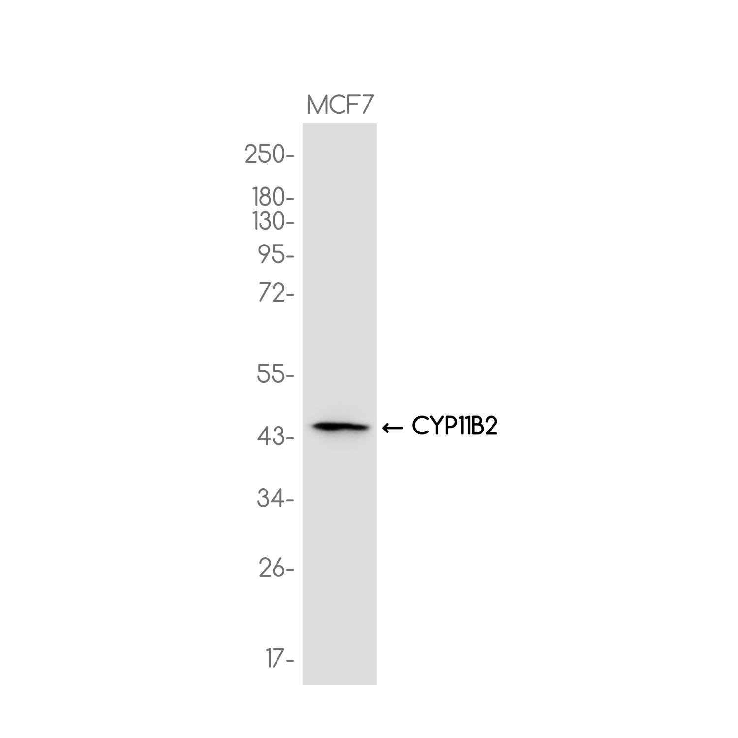 C11B2/CYP11B2 Rabbit mAb ABZ3717