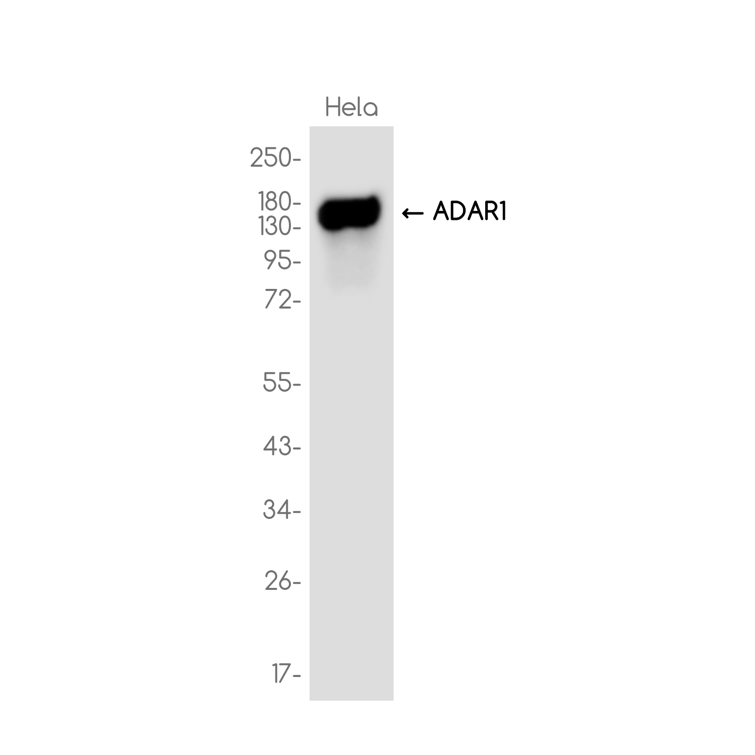 ADAR1 Rabbit mAb ABZ3721
