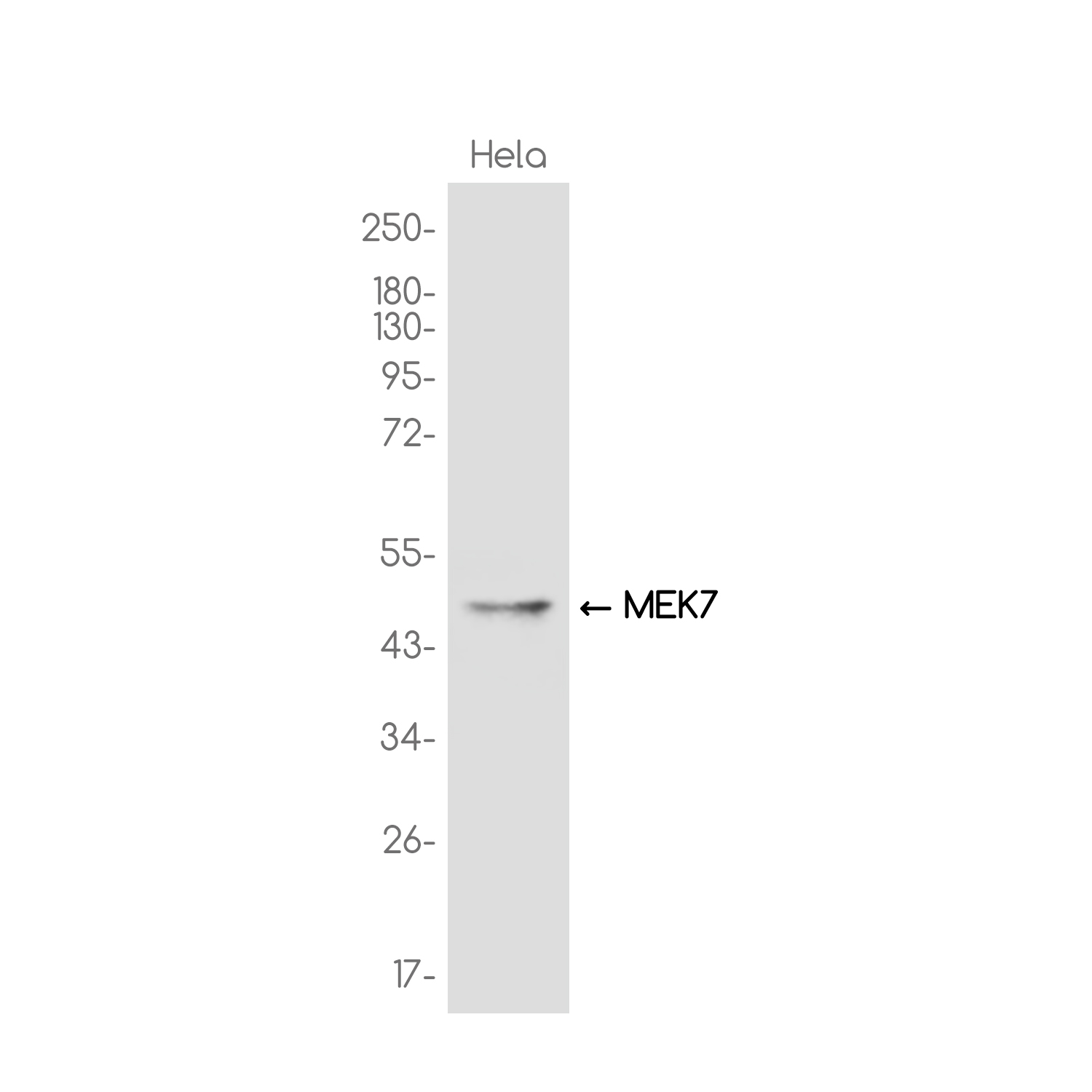 MKK7  Rabbit mAb ABZ3722