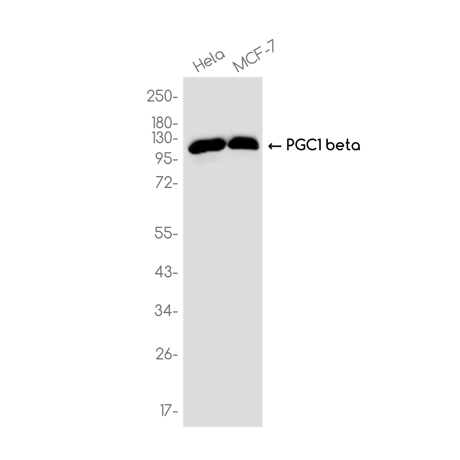 PGC1 beta Rabbit mAb ABZ3723