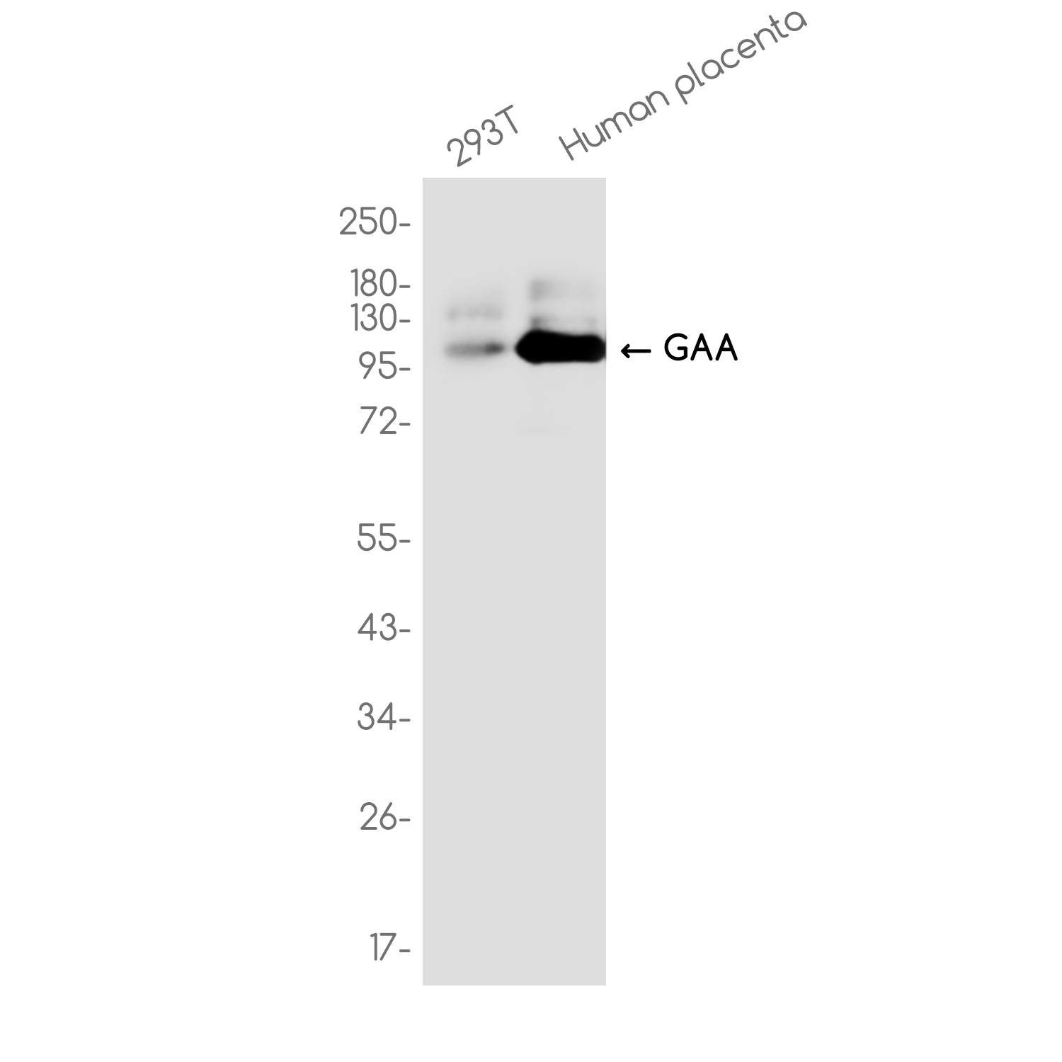 GAA Rabbit mAb ABZ3724