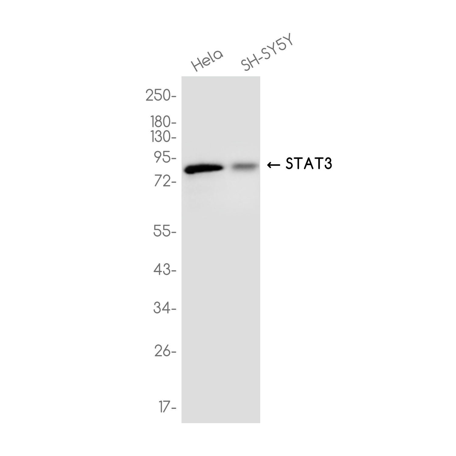 STAT3 Rabbit mAb ABZ3725