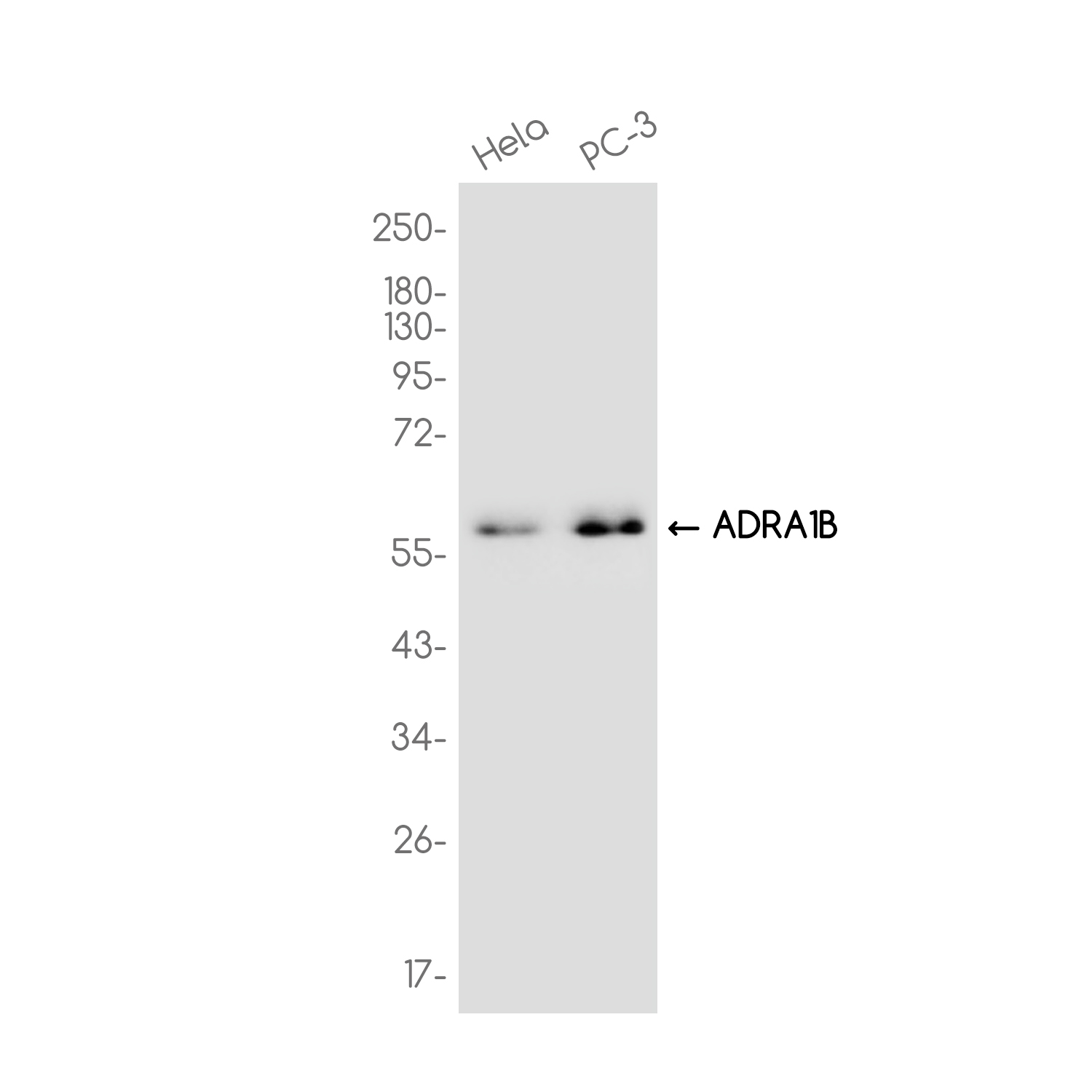 ADRA1B Rabbit mAb ABZ3727