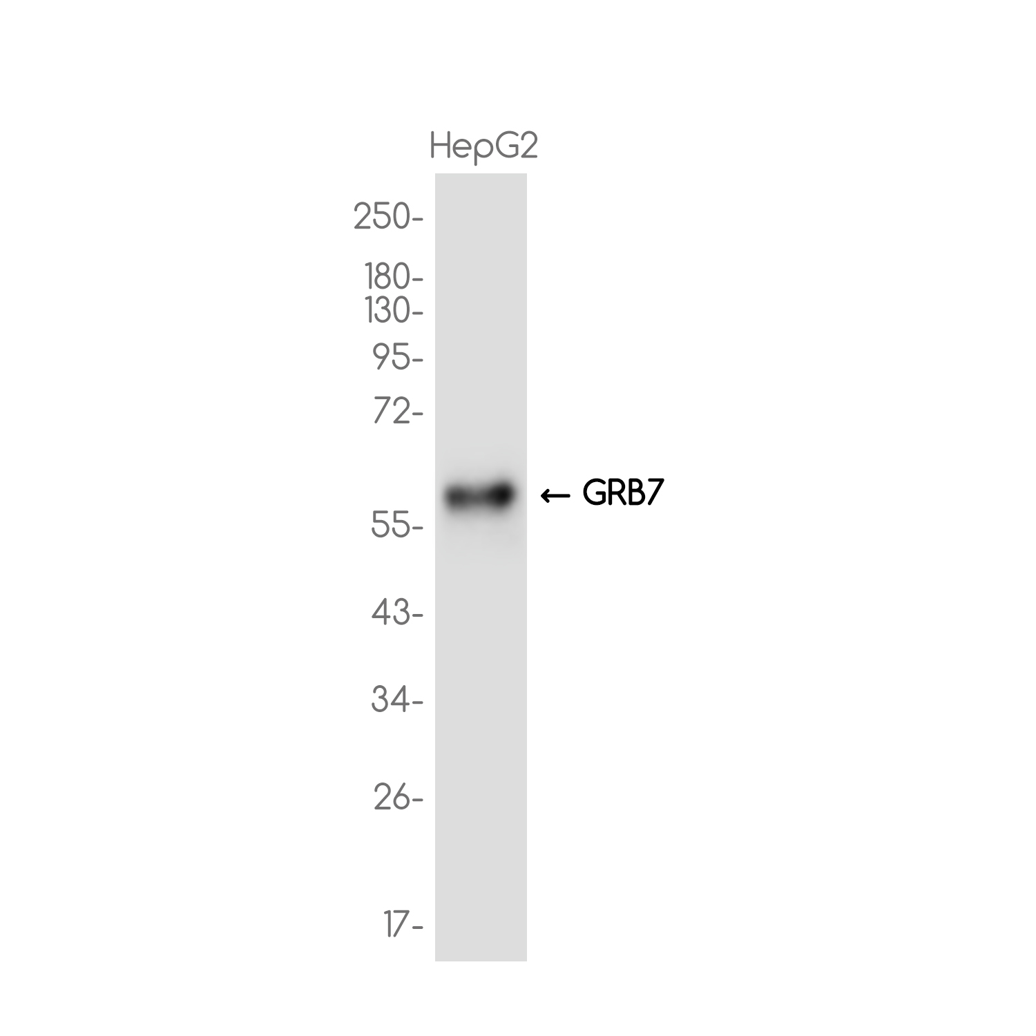 GRB7 Rabbit mAb ABZ3731