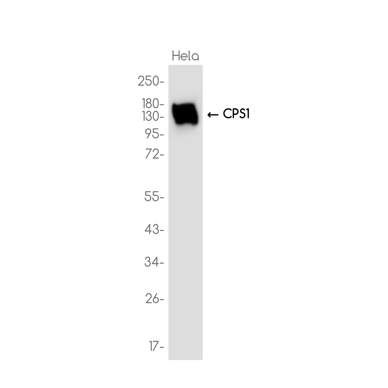 CPS1 Rabbit mAb ABZ3733