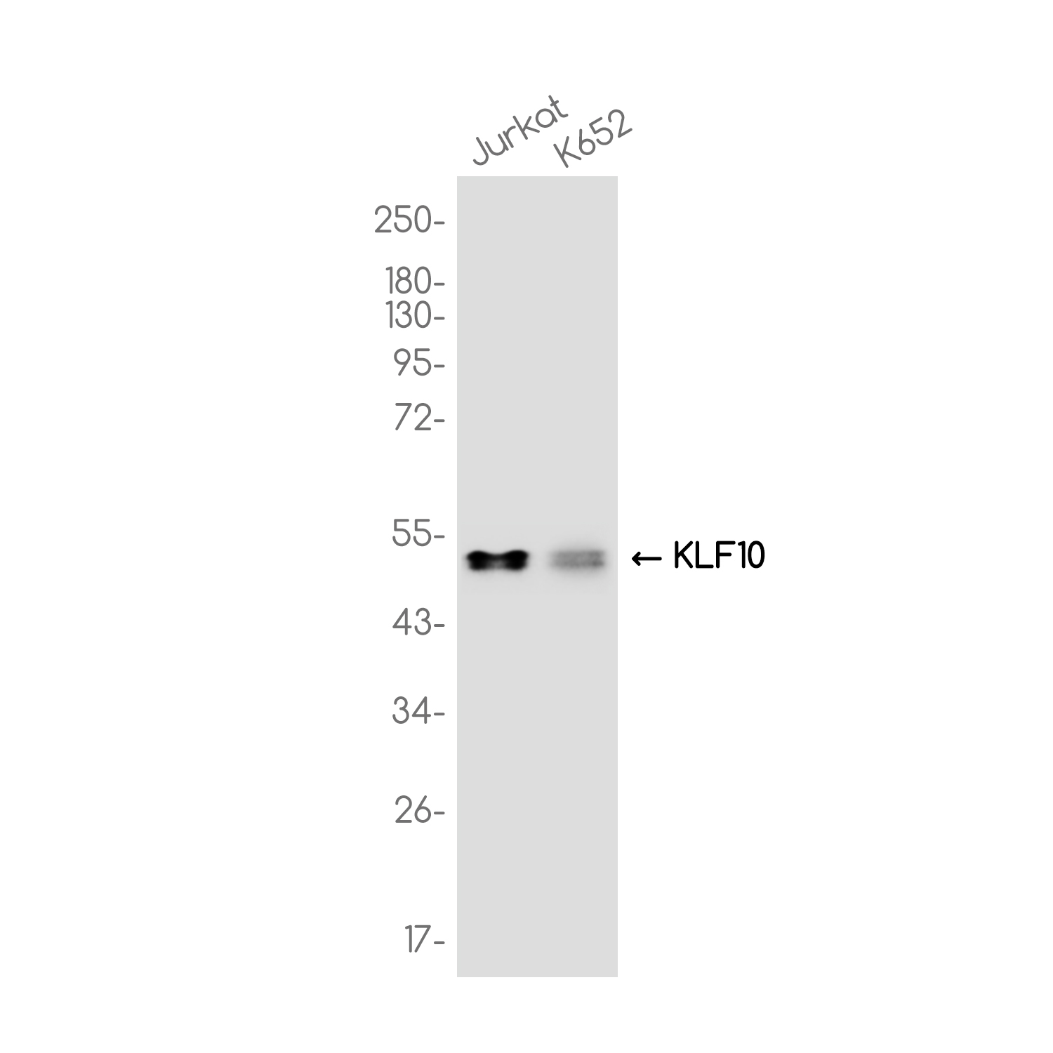KLF10 Rabbit mAb ABZ3735