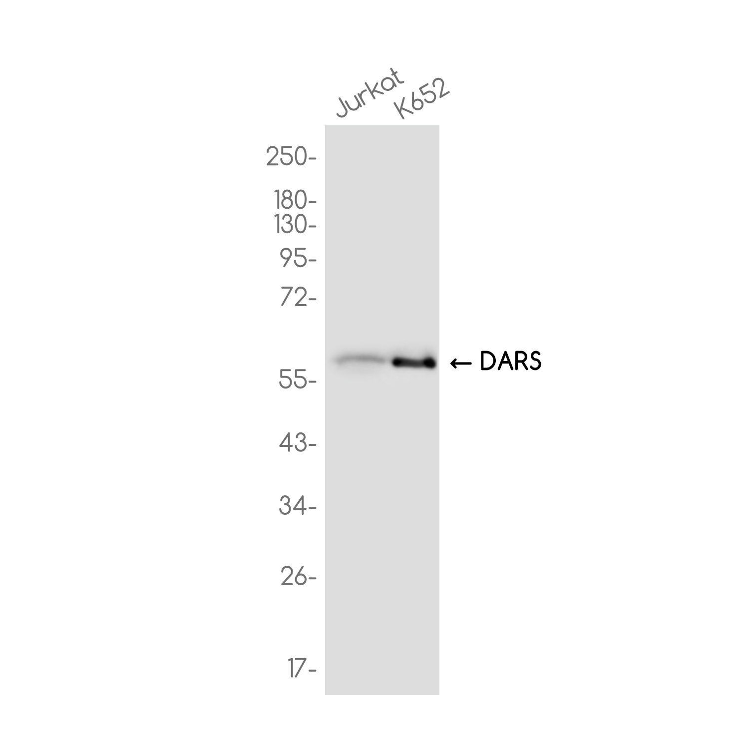 DARS Rabbit mAb ABZ3736