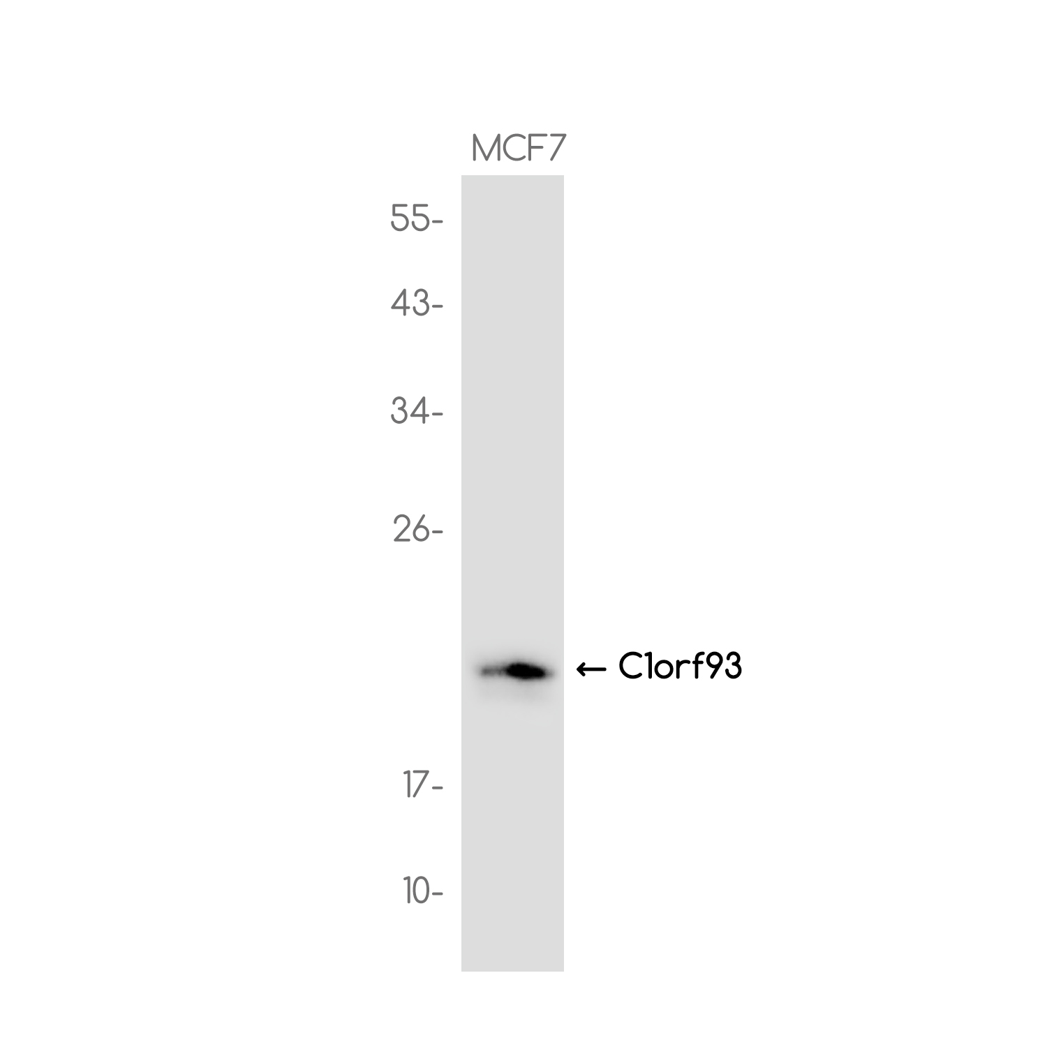 C1orf93 Rabbit mAb ABZ3737