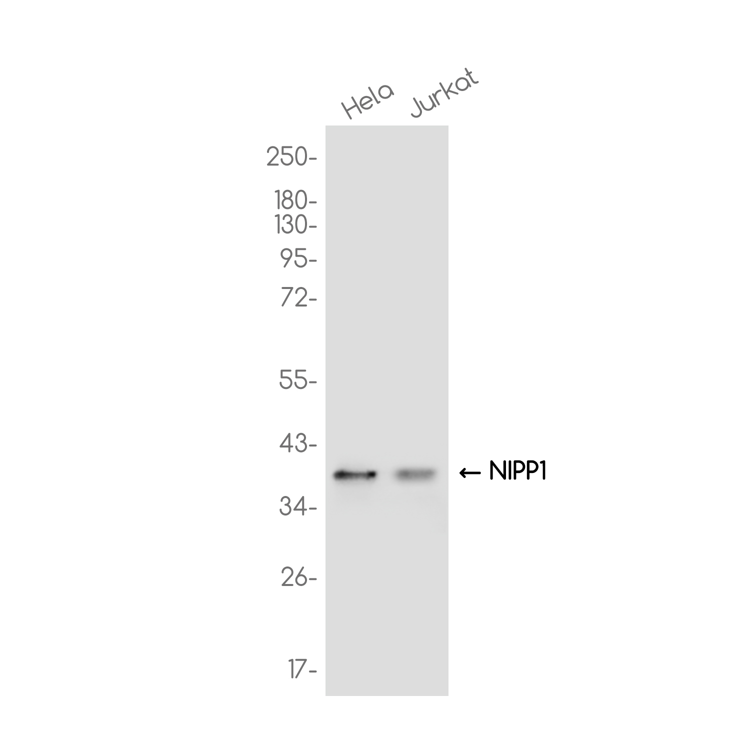 NIPP1 Rabbit mAb ABZ3740
