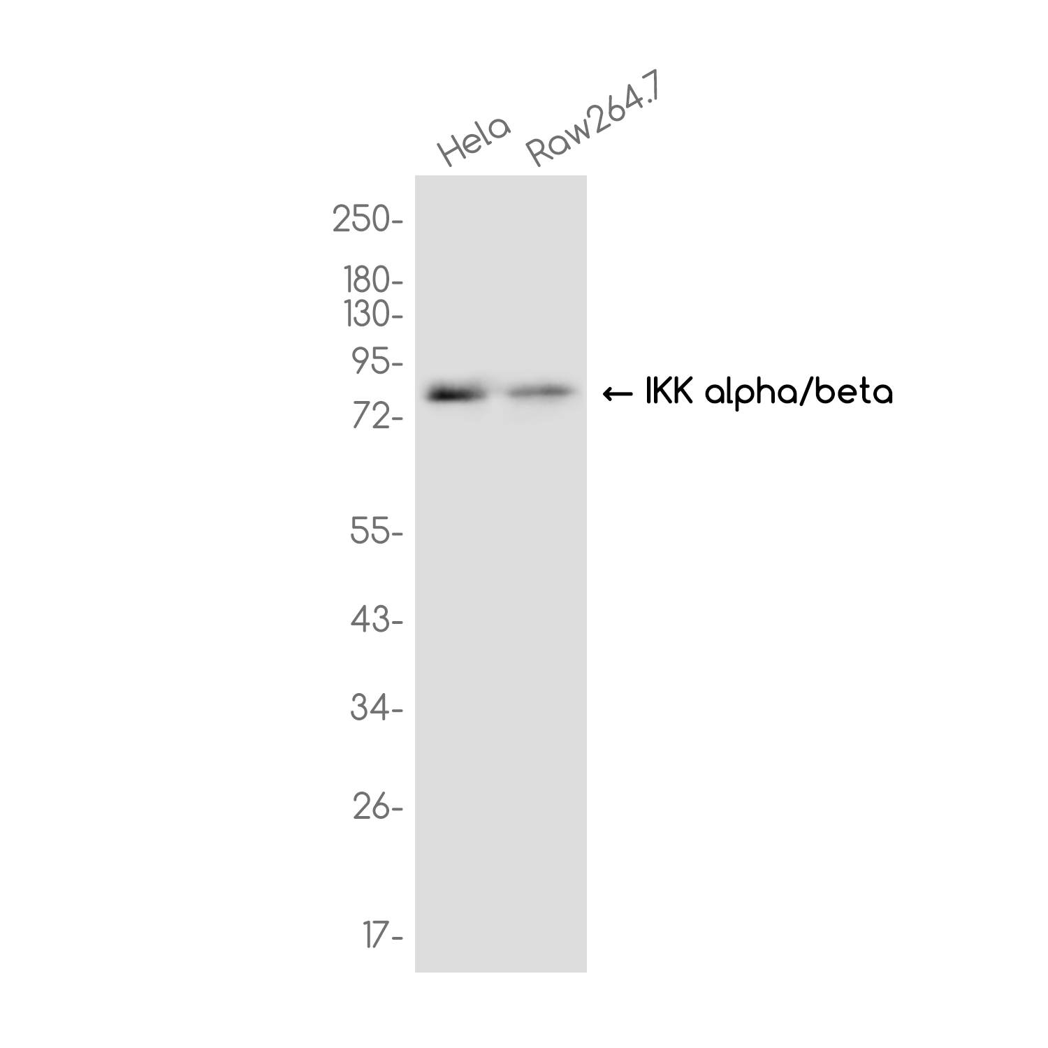 IKK alpha/beta Rabbit mAb ABZ3741