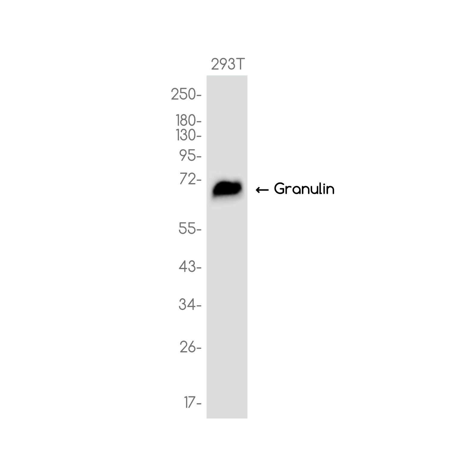 Granulin Rabbit mAb ABZ3743